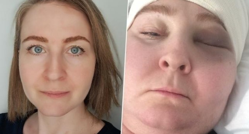 40-letnia Monika Kaleta zbiera pieniądze na operację neurochirurgiczną w Kluczborku. Do zabiegu pozostało tylko kilka dni/fot.: archiwum prywatne 